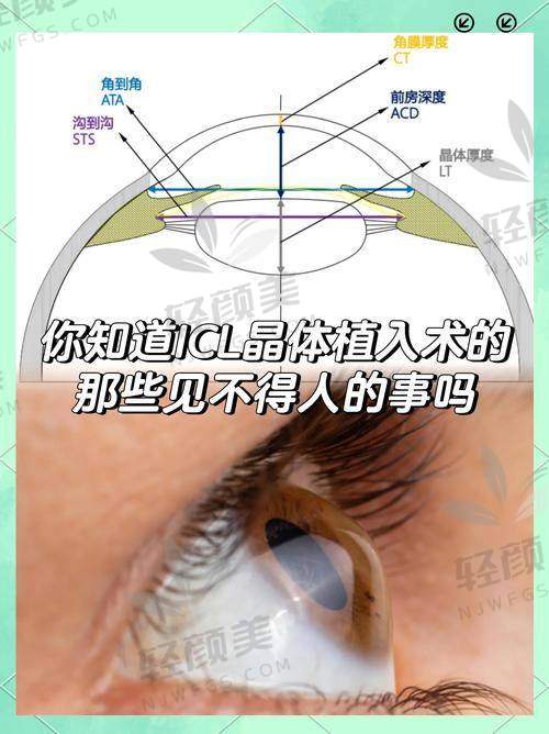 五、三焦点人工晶体适合哪些人？哪些人别碰？