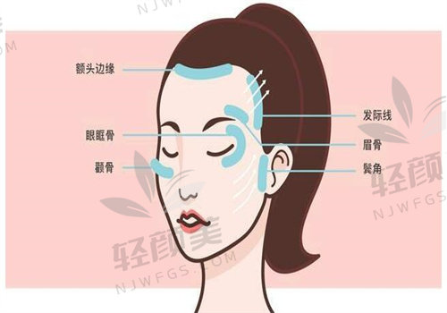 亲身体验黄寅守v9面部提升，效果惊人！黄寅守做面部提升超棒，口碑也是没得说！