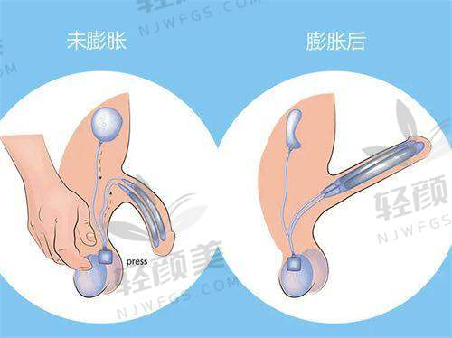 【中卫市薇悦美医疗美容医院地址及乘车路线】