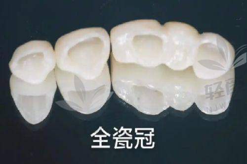 【银川市金凤区欧诺口腔门诊部是正规的吗】