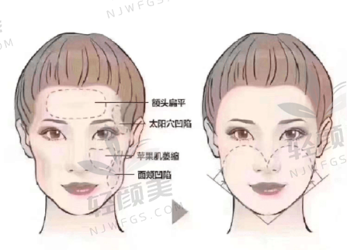 【吴忠市谢俪医疗美容医院地址及乘车路线】