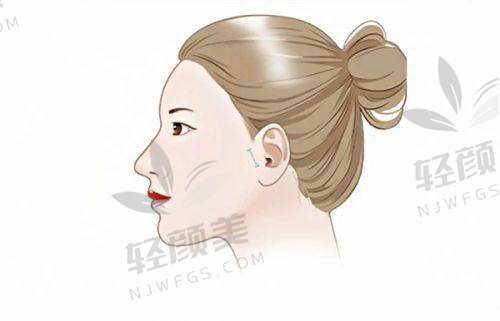 【吴忠市谢俪医疗美容医院口碑怎么样】