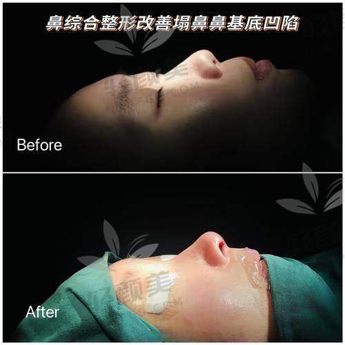 医生简介：多年磨一剑，静心打造美学标杆