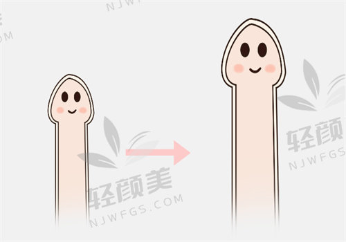 男性生物补片到底好不好？从技术原理到临床案例，全方位解读手术真相！