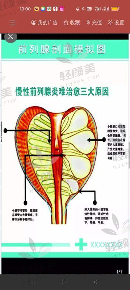? 谁适合这项手术？别盲目冲动上车！