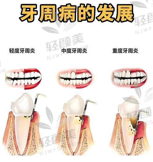 九、互动时间：你的牙套用了哪种弓丝？体验如何？