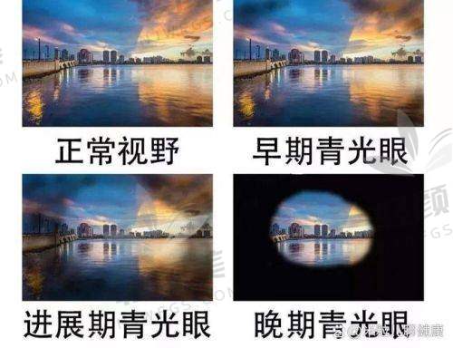 1️⃣ 基因疗法——有没有可能“重启视神经”？