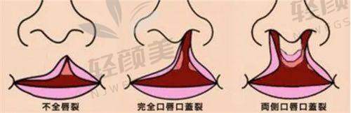 【克拉玛依市人民医院整形科营业时间是什么时候】