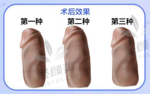 【克拉玛依市人民医院整形科技术特点】