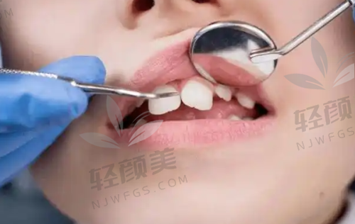 【石嘴山平罗县小白象口腔诊所擅长什么项目】