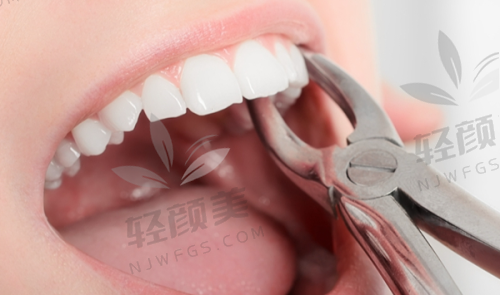 检查牙槽骨状态怎么做？这些手段帮你看得清清楚楚