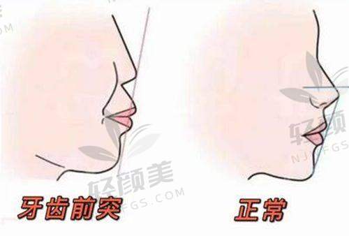 【石嘴山平罗县艾美口腔诊所擅长什么项目】