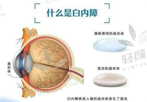 顾青医生技术特点：用科技和人文，把“良医”二字写满