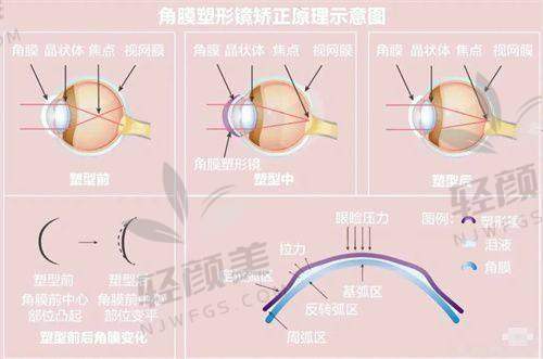 【青海省交通医院眼科地址及乘车路线】