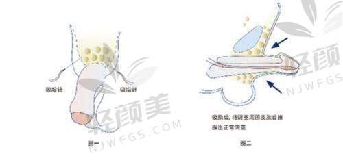 【乌鲁木齐市友谊医院整形科口碑怎么样】