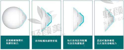 【西宁爱尔眼科医院仪器设备有哪些】