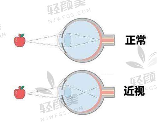 【中卫爱尔眼科医院擅长什么项目】