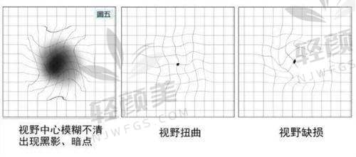 【青海省交通医院眼科是正规的吗】