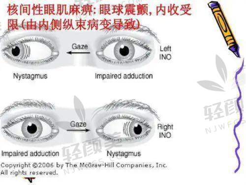 【青海省第五人民医院眼科仪器设备有哪些】