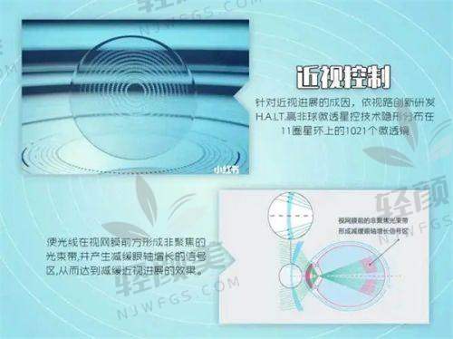 【中卫爱尔眼科医院是正规的吗】