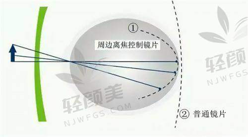 【中卫爱尔眼科医院仪器设备有哪些】