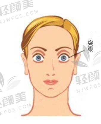【青海省交通医院眼科医生名单】