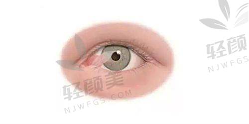 【青海省中医院眼科医生名单】