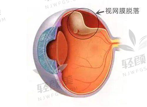 【青海省中医院眼科擅长什么项目】