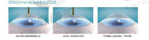【青海省交通医院眼科擅长什么项目】