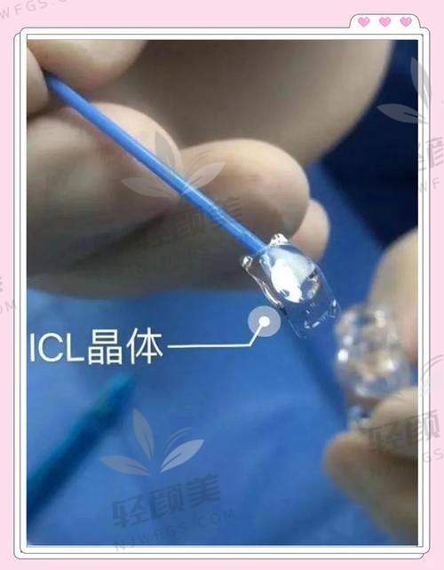 真实体验反馈：术后体验如何？