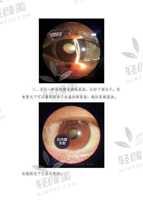 刘国伟医生的擅长项目到底怎么样？