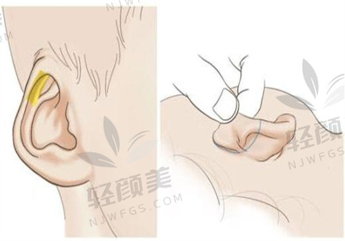 北京米兰柏羽丽都医疗美容医院价格表曝光，微整、脂肪填充、耳再造性价比超高