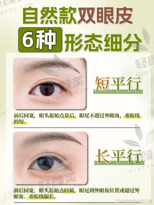 术前纠结与了解