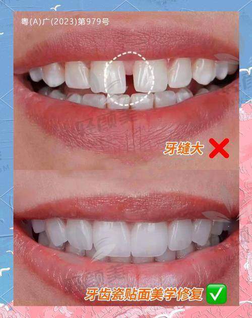 总结