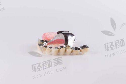 术后修复情况