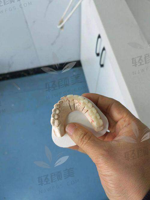 初诊体验