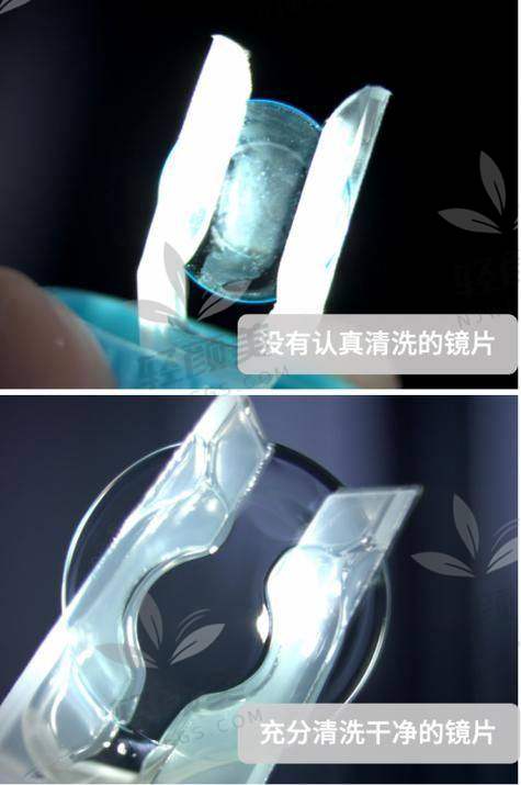 一、角膜塑形镜到底是什么？跟普通隐形眼镜有啥不一样？