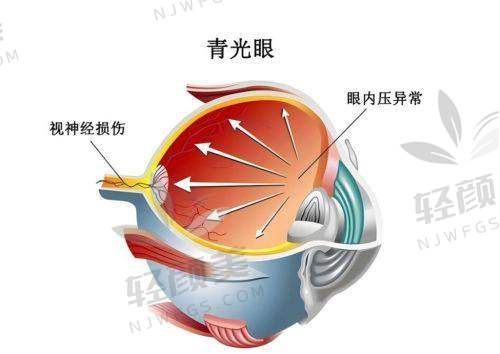 赵青医生技术特点