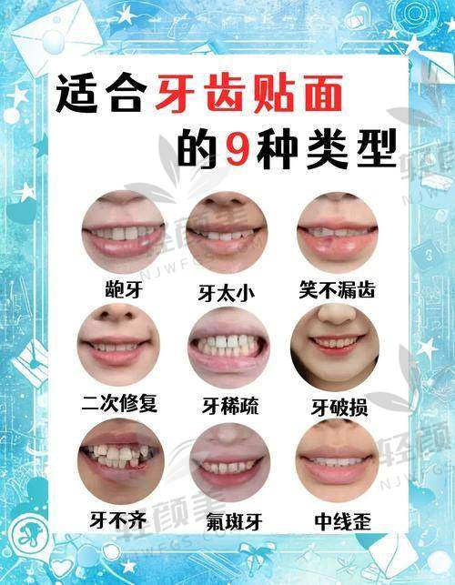 收费标准