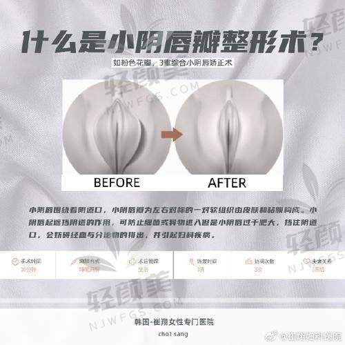 侯智慧医生的专精与贴心