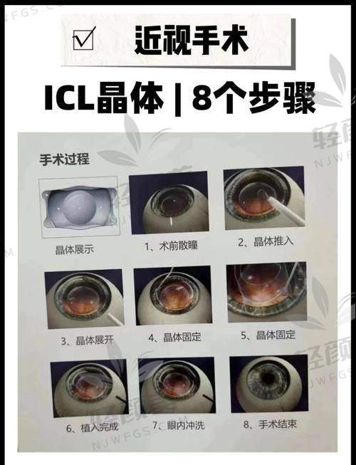 四、哪些人适合植入蔡司晶体？看看你中招没？