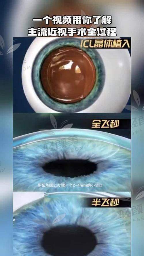 八、写在末尾：选蔡司晶体，值吗？