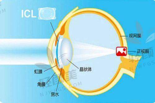 七、蔡司晶体PK其他品牌：谁打谁？