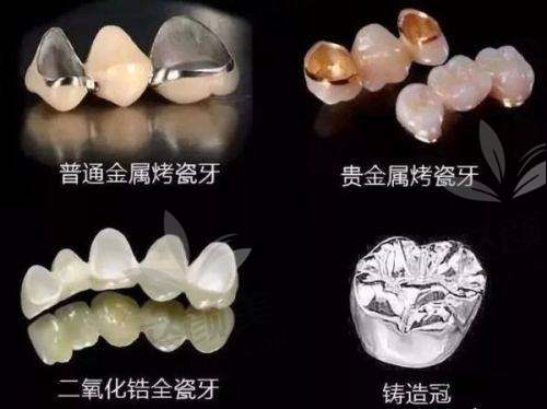 6️⃣ 温馨叮嘱：别只盯材料，还得选对医院 + 医生