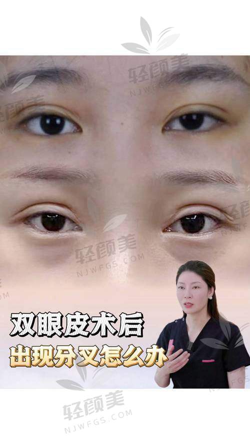 范寅华医生擅长项目