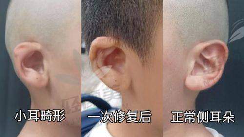 【西宁青美医疗美容医院营业时间是什么时候】
