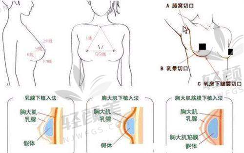 【西宁青美医疗美容医院口碑怎么样】