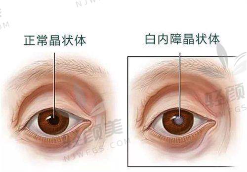 结语：不做“盲选”，选对才是王道！