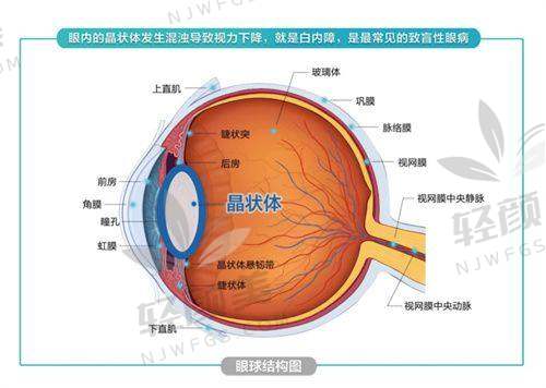 二、晶体型号超懒人对比：哪个适合你？