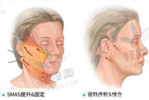 【西宁青美医疗美容医院擅长什么项目】